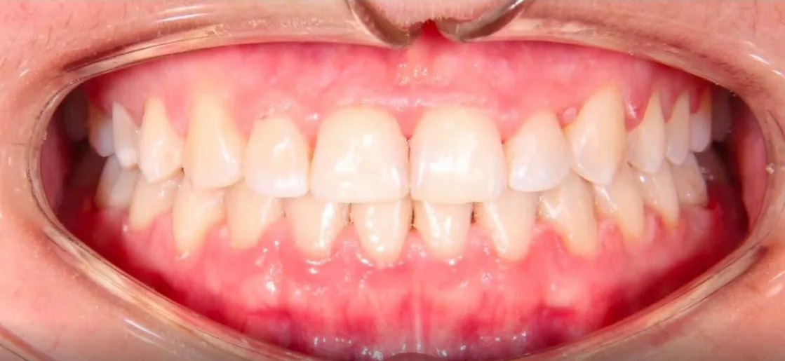 Улыбка после лечения — результат стоматологии Dental Centre