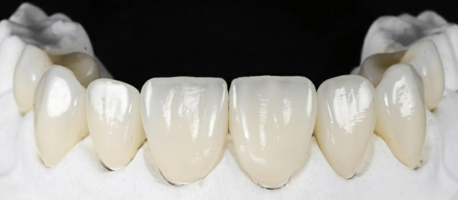 Сколько стоит протезирование зубов — цены в 2026 году