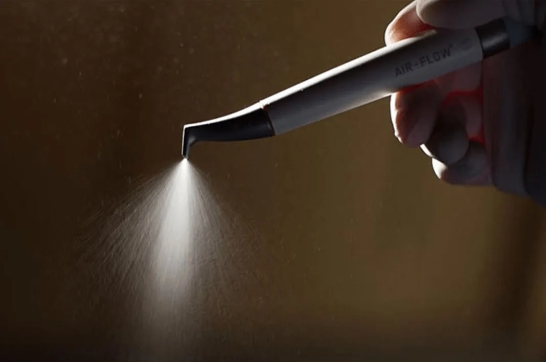 Чистка зубов Air Flow — удаление налёта в Dental Centre Красногорск